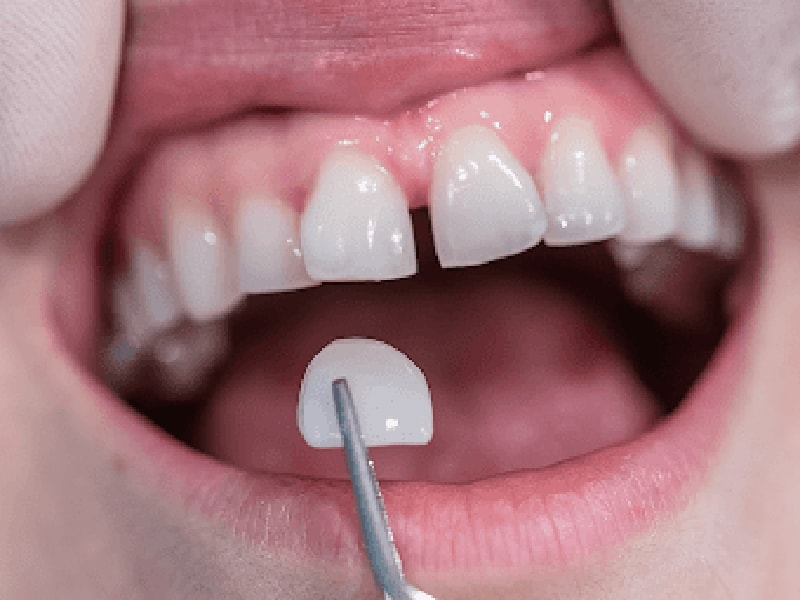 Imagem de Odontologia Digital