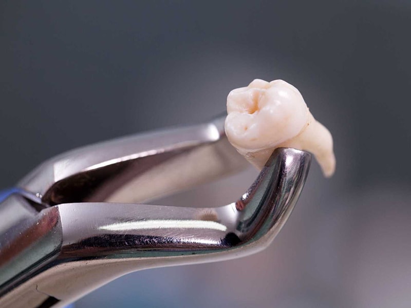Imagem de Odontologia Digital