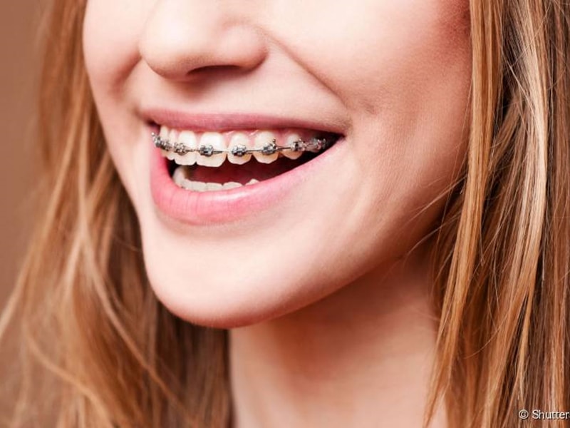 Imagem de Odontologia Digital